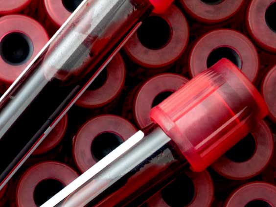 APERTURA NUOVO PUNTO DI PRELIEVI di Montappone (FM) – Via 8 marzo 63835